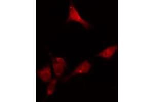 ABIN6274116 staining HeLa cells by IF/ICC. (DKC1 anticorps  (Internal Region))