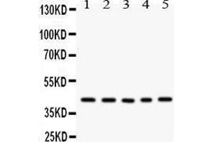 Western Blotting (WB) image for anti-Cysteine-Rich, Angiogenic Inducer, 61 (CYR61) (AA 54-381) antibody (ABIN3042351) (CYR61 anticorps  (AA 54-381))