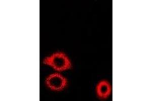 Immunofluorescent analysis of ADE2 staining in U2OS cells. (PAICS anticorps)