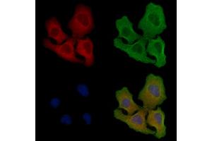 ABIN6258909 and ABIN6275877 staining Hela cells by IF/ICC.