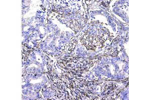 IHC analysis of CD44 using anti-CD44 antibody .