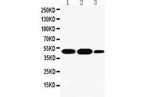 Anti-INDOL1 antibody, Western blotting Lane 1: A549 Cell Lysate Lane 2: Human Placenta Tissue Lysate Lane 3: A431 Cell Lysate (IDO2 anticorps  (N-Term))
