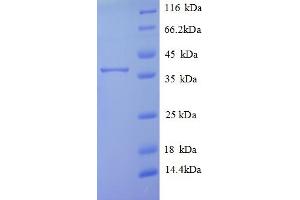 SDS-PAGE (SDS) image for Transmembrane Protein 14B (TMEM14B) (AA 1-114), (full length) protein (GST tag) (ABIN5710508)