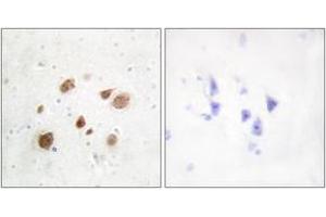 Immunohistochemistry analysis of paraffin-embedded human brain tissue, using CaMK1-beta Antibody.