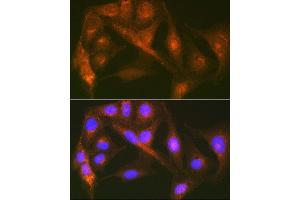 Immunofluorescence analysis of U-2 OS cells using Cortactin Rabbit mAb (ABIN7266511) at dilution of 1:100 (40x lens).