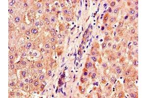 Immunohistochemistry of paraffin-embedded human liver tissue using ABIN7162949 at dilution of 1:100 (ACOX1 anticorps  (AA 113-273))