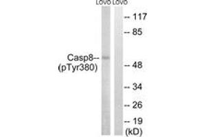 Western blot analysis of extracts from LOVO cells treated with UV 15', using Caspase 8 (Phospho-Tyr380) Antibody. (Caspase 8 anticorps  (pTyr380))