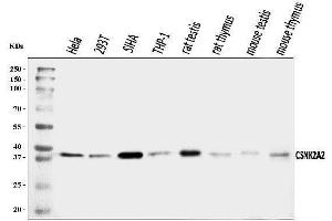 Western blot analysis of CSNK2A2 using anti-CSNK2A2 antibody (ABIN7602871).