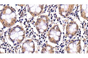 Detection of CASP10 in Human Colon Tissue using Polyclonal Antibody to Caspase 10 (CASP10) (Caspase 10 anticorps  (AA 223-459))