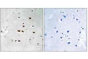 Immunohistochemistry analysis of paraffin-embedded human brain tissue using ITCH (Phospho-Tyr420) antibody. (ITCH anticorps  (pTyr420))