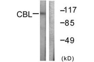 Western blot analysis of extracts from HeLa cells, treated with EGF 200ng/ml 30', using CBL (Ab-774) Antibody. (CBL anticorps  (AA 740-789))
