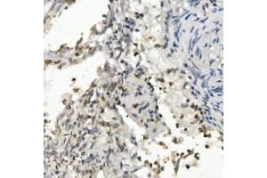 IHC analysis of FOXF1 using anti-FOXF1 antibody (ABIN7601744). (FOXF1 anticorps  (AA 44-379))