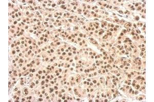 IHC-P Image XRCC4 antibody detects XRCC4 protein at nucleus on HBL435 xenograft by immunohistochemical analysis.