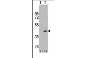 Image no. 1 for anti-Mitogen-Activated Protein Kinase Kinase 4 (MAP2K4) (Ser257) antibody (ABIN360303) (MAP2K4 anticorps  (Ser257))