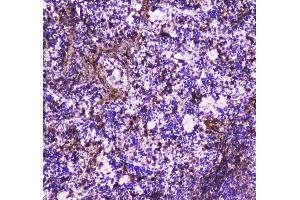IHC analysis of Annexin VI using anti-Annexin VI antibody .
