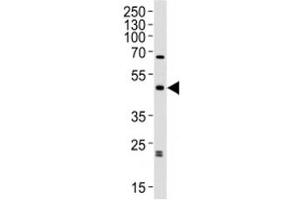 Western blot analysis of lysate from human brain tissue lysate using ABHD12 antibody diluted at 1:1000. (ABHD12 anticorps  (AA 40-66))