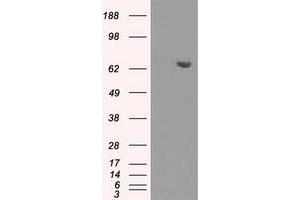 HEK293T cells were transfected with the pCMV6-ENTRY control (Left lane) or pCMV6-ENTRY HDAC10 (Right lane) cDNA for 48 hrs and lysed. (HDAC10 anticorps)