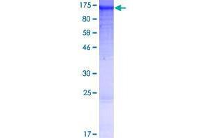 Image no. 1 for Ankyrin Repeat Domain 27 (VPS9 Domain) (ANKRD27) (AA 1-1050) protein (GST tag) (ABIN1345103)