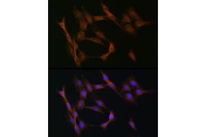 Immunofluorescence analysis of C6 cells using TGF beta Receptor II (TGF beta Receptor II (TGFBR2)) Rabbit pAb (ABIN6130734, ABIN6149084, ABIN6149087 and ABIN6215460) at dilution of 1:50 (40x lens). (TGFBR2 anticorps  (AA 23-280))