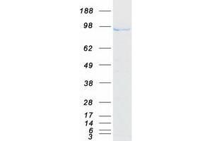 Validation with Western Blot