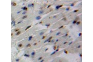 IHC-P analysis of Heart tissue, with DAB staining. (SMAD6 anticorps  (AA 116-364))