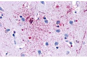 Anti-GPR139 antibody  ABIN1048723 IHC staining of human brain, neurons and glia. (GPR139 anticorps  (Transmembrane Domain))