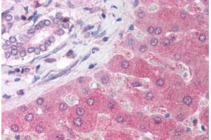 Human Liver (formalin-fixed, paraffin-embedded) stained with PARP2 antibody ABIN214132 at 5 ug/ml followed by biotinylated goat anti-rabbit IgG secondary antibody ABIN481713, alkaline phosphatase-streptavidin and chromogen.