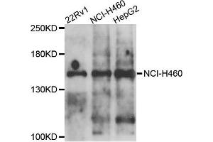 Western blot analysis of extracts of various cells, using COL4A5 antibody. (COL4a5 anticorps)