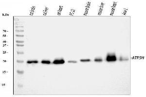 Western blot analysis of ATP5H using anti-ATP5H antibody (ABIN3043795).