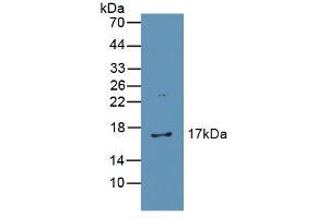 Western blot analysis of recombinant Human CAT. (Catalase anticorps  (AA 32-167))