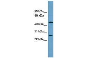 Image no. 1 for anti-Elongator Acetyltransferase Complex Subunit 4 (ELP4) (AA 101-150) antibody (ABIN6744601) (ELP4 anticorps  (AA 101-150))