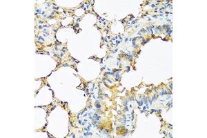 Immunohistochemistry of paraffin-embedded mouse lung using TSHB antibody (ABIN6132751, ABIN6149620, ABIN6149621 and ABIN6222522) at dilution of 1:100 (40x lens).