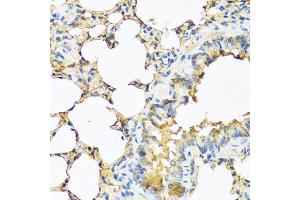 Immunohistochemistry of paraffin-embedded mouse lung using TSHB antibody (ABIN6132751, ABIN6149620, ABIN6149621 and ABIN6222522) at dilution of 1:100 (40x lens). (TSHB anticorps  (AA 21-138))