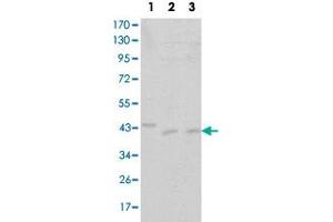 Western blot analysis of CDK9 monoclonal antibody, clone 1B5D10  against Jurkat (1), A-431 (2) and HEK293 (3) cell lysate.