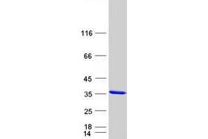 Validation with Western Blot