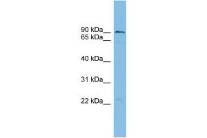 WB Suggested Anti-TBC1D16 Antibody Titration: 0.