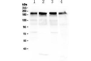 Laminin gamma 1 anticorps  (all Isoforms)