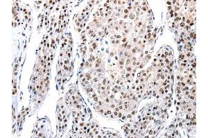 Immunohistochemistry (IHC) image for anti-Aquaporin 2 (Collecting Duct) (AQP2) antibody (ABIN2425578) (AQP2 anticorps)