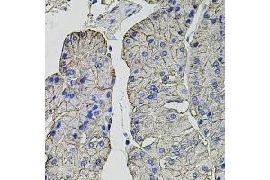 Immunohistochemistry of paraffin-embedded human stomach using Carbonic Anhydrase 9 (C/G250) antibody (ABIN6131266, ABIN6137798, ABIN6137800 and ABIN6217767) at dilution of 1:100 (40x lens).