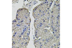 Immunohistochemistry of paraffin-embedded human stomach using Carbonic Anhydrase 9 (C/G250) antibody (ABIN6131266, ABIN6137798, ABIN6137800 and ABIN6217767) at dilution of 1:100 (40x lens). (CA9 anticorps  (AA 52-151))