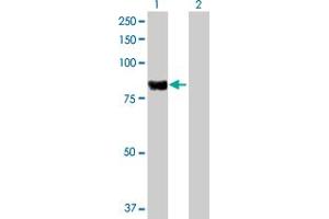 Western Blot analysis of PLA2G6 expression in transfected 293T cell line by PLA2G6 MaxPab polyclonal antibody.