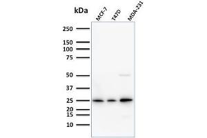 Western Blot Analysis of Human MCF-7,T47D and MDA-231 cell lysate using Monospecific Mouse Monoclonal Antibody (SPM518) to Mammaglobin. (Mammaglobin A anticorps)