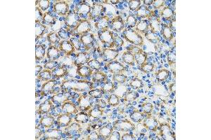 Immunohistochemistry of paraffin-embedded rat kidney using CTNNA1 antibody.