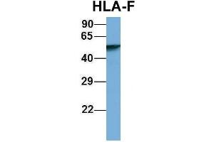 Host:  Rabbit  Target Name:  HLA-F  Sample Type:  Human Fetal Lung  Antibody Dilution:  1. (HLA-F anticorps  (N-Term))
