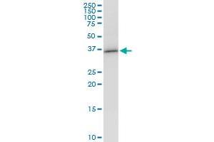 VAX1 monoclonal antibody (M03), clone 2F4.