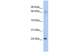RPL18 antibody used at 1 ug/ml to detect target protein. (RPL18 anticorps  (N-Term))