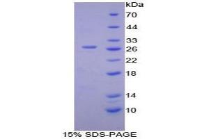 SDS-PAGE analysis of Mouse CAMK2g Protein. (CAMKII gamma Protéine)