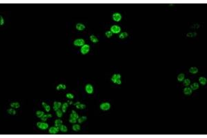 Immunofluorescent analysis of HepG2 cells using ABIN7139618 at dilution of 1:100 and Alexa Fluor 488-congugated AffiniPure Goat Anti-Rabbit IgG(H+L) (Histone H1.5 anticorps  (pSer188))