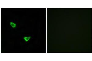 Immunofluorescence analysis of MCF-7 cells, using CHSS2 antibody. (CHPF anticorps  (C-Term))