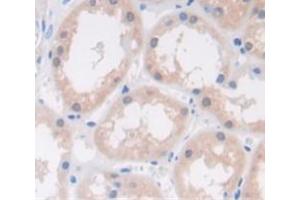 Figure. (RNASE6 anticorps  (AA 25-150))